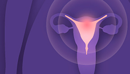 Graficación cuello uterino