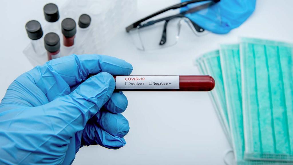 Foto de un tubo con una muestra de sangre, para detectar el nuevo coronavirus Eduardo Behrentz
