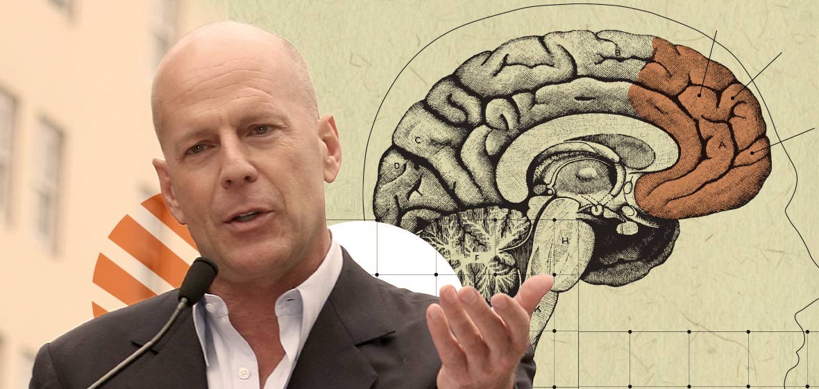 Demencia frontotemporal y Bruce Willis: qué es, síntomas y causas