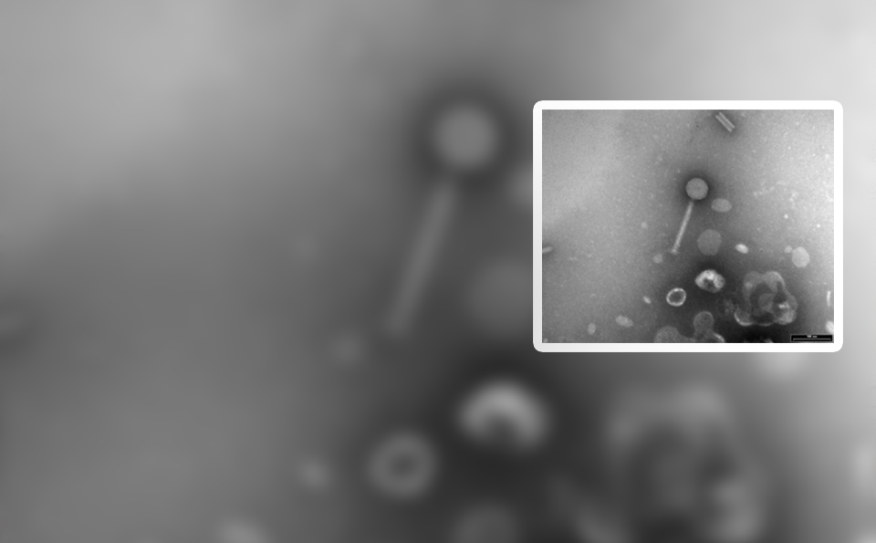 imagen en blanco y negro de bacteriófagos, virus que atacan bacterias de forma selectiva