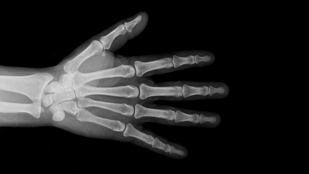 Radiografía de mano